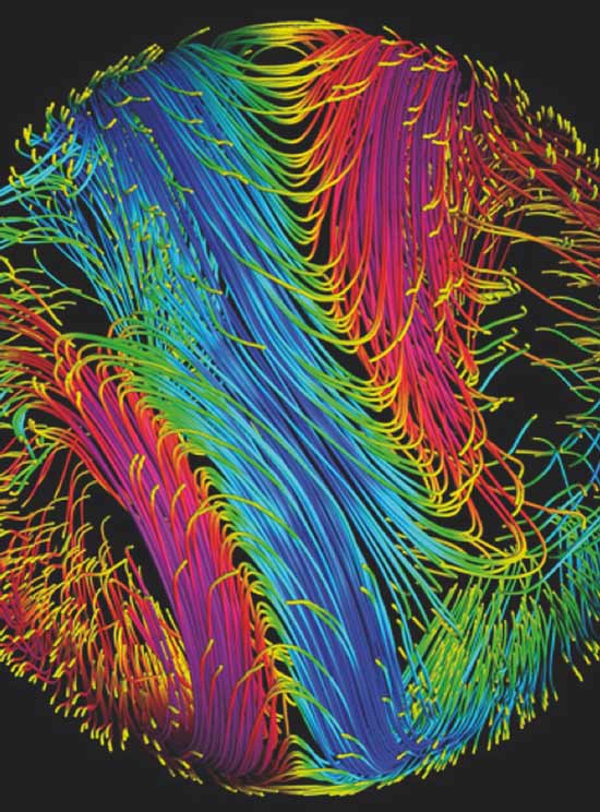 Ein bunter Fadenwirbel